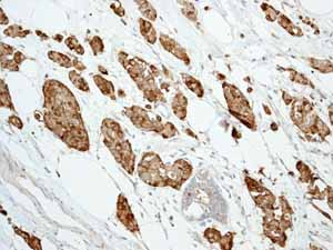 Immunohistochemistry (Formalin/PFA-fixed paraffin-embedded sections) - Anti-Trefoil Factor 3 antibody [EPR3974] (AB108599)