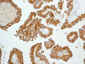 Immunohistochemistry (Formalin/PFA-fixed paraffin-embedded sections) - Anti-Trefoil Factor 3 antibody [EPR3974] (AB108599)