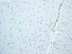 Immunohistochemistry (Formalin/PFA-fixed paraffin-embedded sections) - Anti-Trefoil Factor 3 antibody [EPR3974] (AB108599)