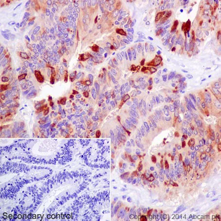 Immunohistochemistry (Formalin/PFA-fixed paraffin-embedded sections) - Anti-Trefoil Factor 3 antibody [EPR3974] (AB108599)