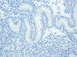 Immunohistochemistry (Formalin/PFA-fixed paraffin-embedded sections) - Anti-Trefoil Factor 3 antibody [EPR3974] (AB108599)