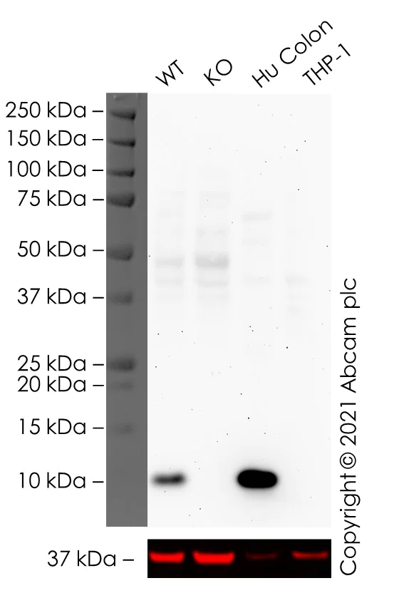 Western blot - Anti-Trefoil Factor 3 antibody [EPR3974] (AB108599)