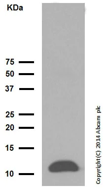 Western blot - Anti-Trefoil Factor 3 antibody [EPR3974] (AB108599)