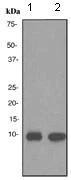 Western blot - Anti-Trefoil Factor 3 antibody [EPR3974] (AB108599)