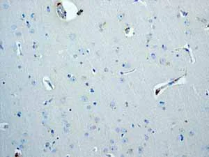 Immunohistochemistry (Formalin/PFA-fixed paraffin-embedded sections) - Anti-Trefoil Factor 3 antibody [EPR3974] - BSA and Azide free (AB239935)