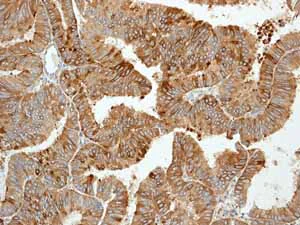 Immunohistochemistry (Formalin/PFA-fixed paraffin-embedded sections) - Anti-Trefoil Factor 3 antibody [EPR3974] - BSA and Azide free (AB239935)