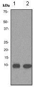 Western blot - Anti-Trefoil Factor 3 antibody [EPR3974] - BSA and Azide free (AB239935)