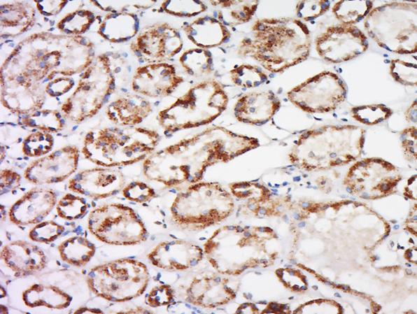 Immunohistochemistry (Formalin/PFA-fixed paraffin-embedded sections) - Anti-Trehalase antibody (AB217293), expandable thumbnail