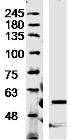 Western blot - Anti-Trehalase antibody (AB217293), expandable thumbnail
