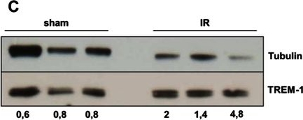 Western blot - Anti-TREM1 antibody (AB104413)