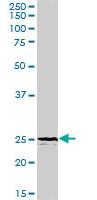 Western blot - Anti-TREM1 antibody (AB104413)