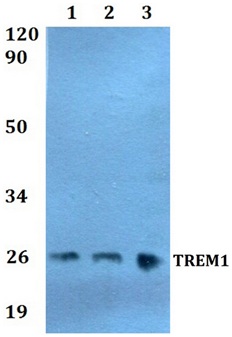 Western blot - Anti-TREM1 antibody (AB200729)