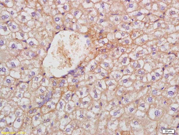 Immunohistochemistry (Formalin/PFA-fixed paraffin-embedded sections) - Anti-TREM1 antibody (AB214202)