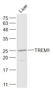 Western blot - Anti-TREM1 antibody (AB214202)