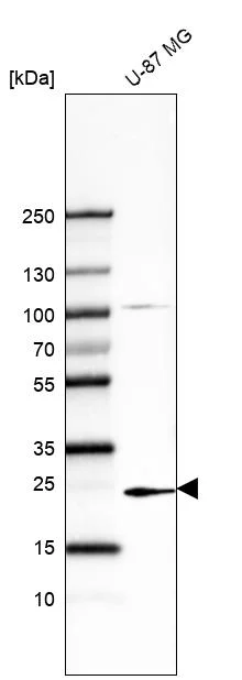 Western blot - Anti-TREM1 Antibody [CL7111] (AB327123)