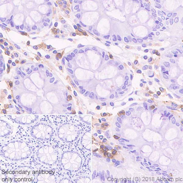 Immunohistochemistry (Formalin/PFA-fixed paraffin-embedded sections) - Anti-TREM1 antibody [EPR22060-229] (AB225861)