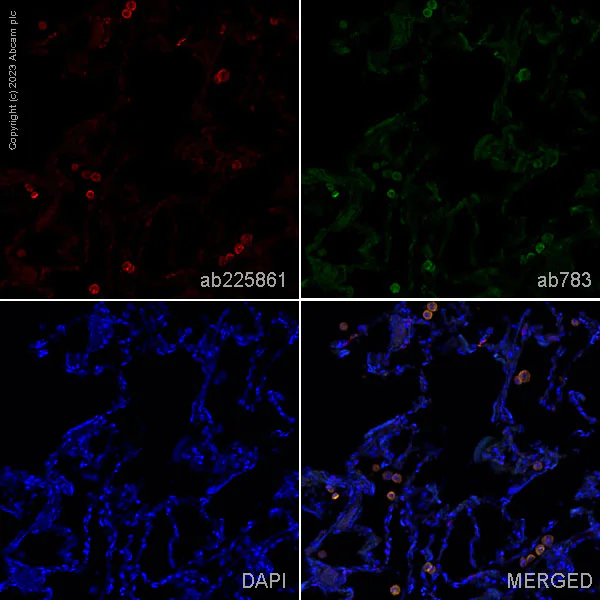 Immunohistochemistry (Formalin/PFA-fixed paraffin-embedded sections) - Anti-TREM1 antibody [EPR22060-229] (AB225861)