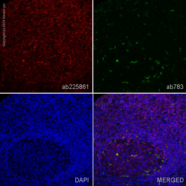 Immunohistochemistry (Formalin/PFA-fixed paraffin-embedded sections) - Anti-TREM1 antibody [EPR22060-229] (AB225861)