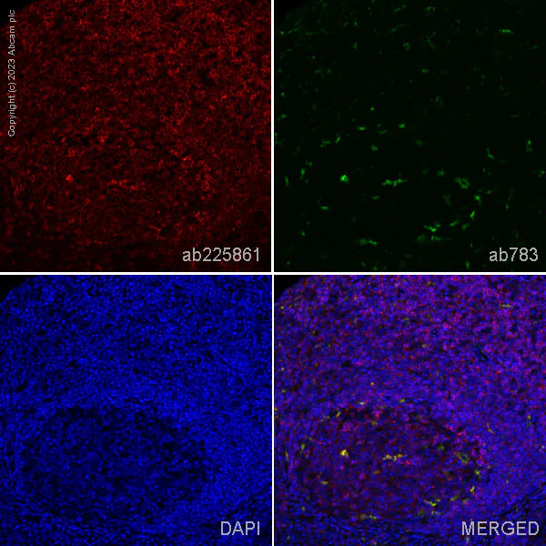 Immunohistochemistry (Formalin/PFA-fixed paraffin-embedded sections) - Anti-TREM1 antibody [EPR22060-229] (AB225861)