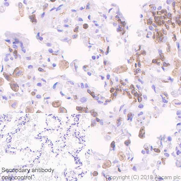 Immunohistochemistry (Formalin/PFA-fixed paraffin-embedded sections) - Anti-TREM1 antibody [EPR22060-229] - BSA and Azide free (AB240824)