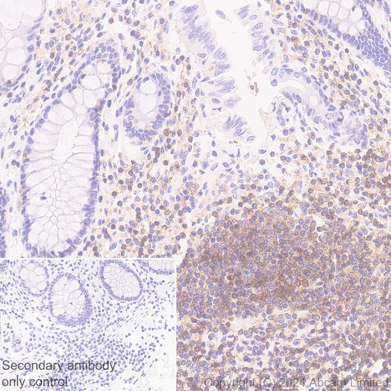 Immunohistochemistry (Formalin/PFA-fixed paraffin-embedded sections) - Anti-TREM1 antibody [EPR22060-229] - Mouse IgG2a (Chimeric) - BSA and Azide free (AB324854)