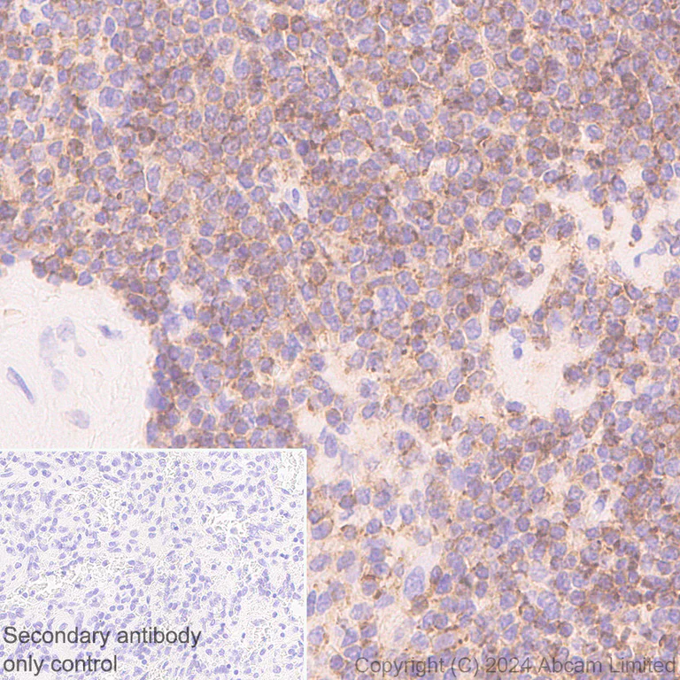 Immunohistochemistry (Formalin/PFA-fixed paraffin-embedded sections) - Anti-TREM1 antibody [EPR22060-229] - Mouse IgG2a (Chimeric) - BSA and Azide free (AB324854)