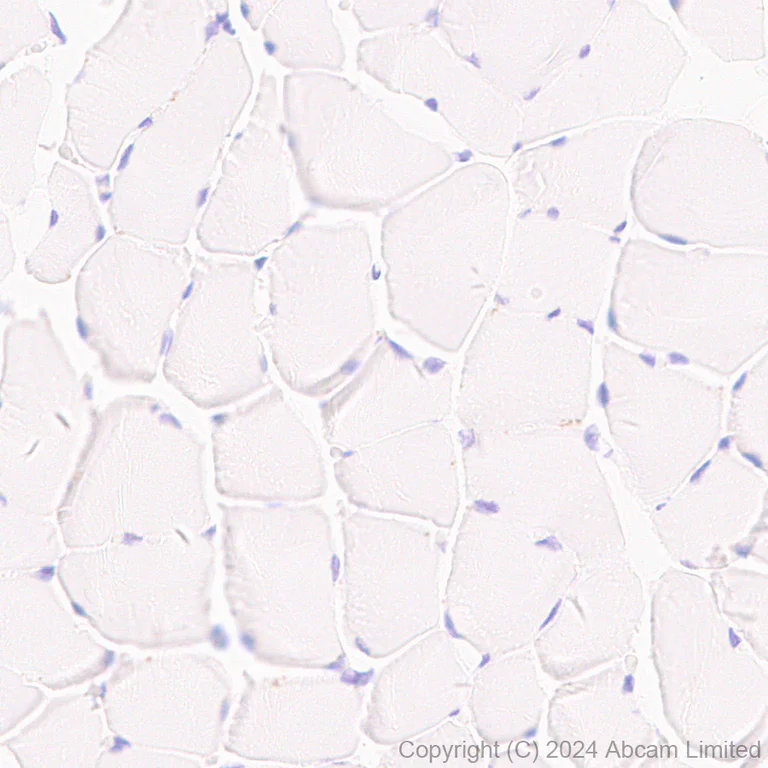 Immunohistochemistry (Formalin/PFA-fixed paraffin-embedded sections) - Anti-TREM1 antibody [EPR22060-229] - Mouse IgG2a (Chimeric) - BSA and Azide free (AB324854)