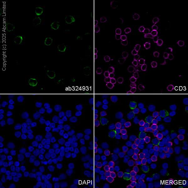 Immunocytochemistry/ Immunofluorescence - Anti-TREM1 antibody [RM1315] (AB324931)