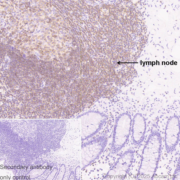 Immunohistochemistry (Formalin/PFA-fixed paraffin-embedded sections) - Anti-TREM1 antibody [RM1315] (AB324931)