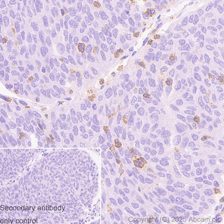 Immunohistochemistry (Formalin/PFA-fixed paraffin-embedded sections) - Anti-TREM1 antibody [RM1315] (AB324931)