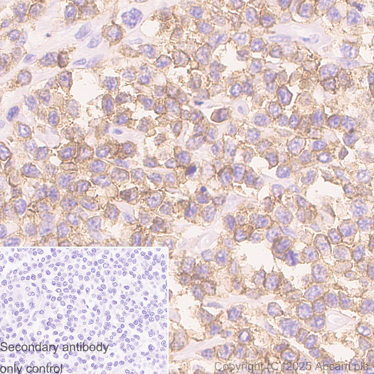 Immunohistochemistry (Formalin/PFA-fixed paraffin-embedded sections) - Anti-TREM1 antibody [RM1315] (AB324931)