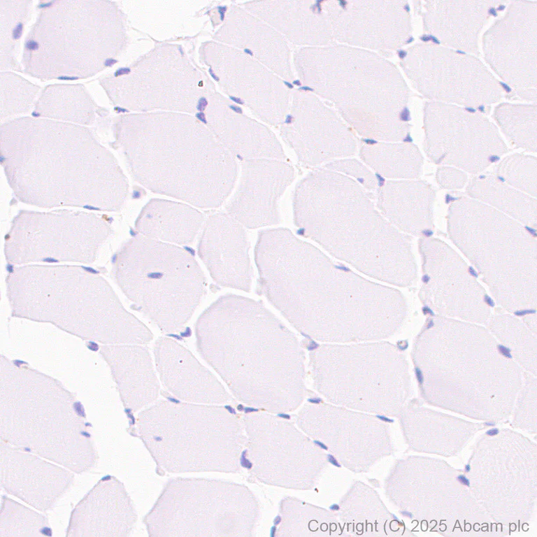 Immunohistochemistry (Formalin/PFA-fixed paraffin-embedded sections) - Anti-TREM1 antibody [RM1315] (AB324931)