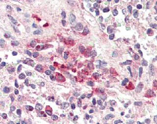 Immunohistochemistry (Formalin/PFA-fixed paraffin-embedded sections) - Anti-TREM2 antibody (AB85851)