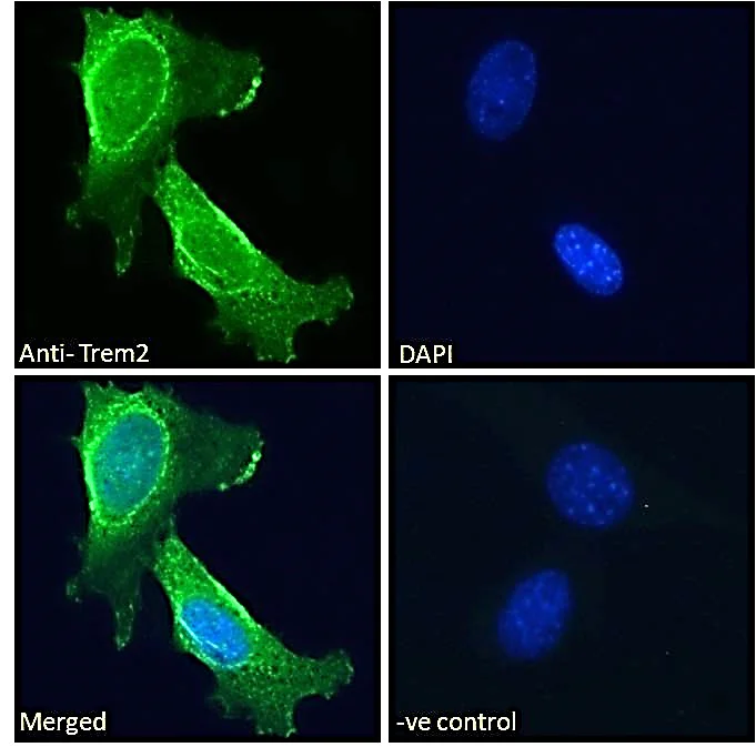 Immunocytochemistry - Anti-TREM2 antibody (AB95470)