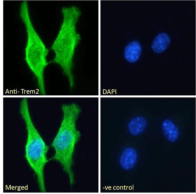 Immunocytochemistry - Anti-TREM2 antibody (AB95470)