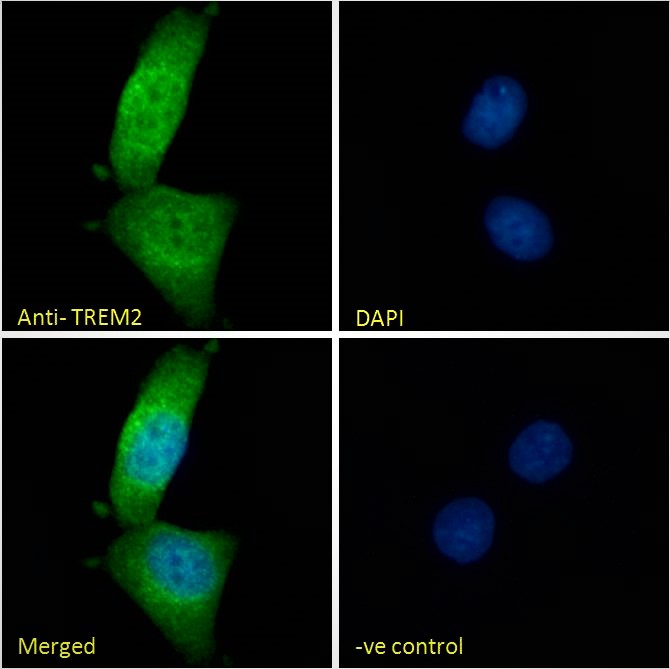 Immunocytochemistry/ Immunofluorescence - Anti-TREM2 antibody - C-terminal (AB223684), expandable thumbnail
