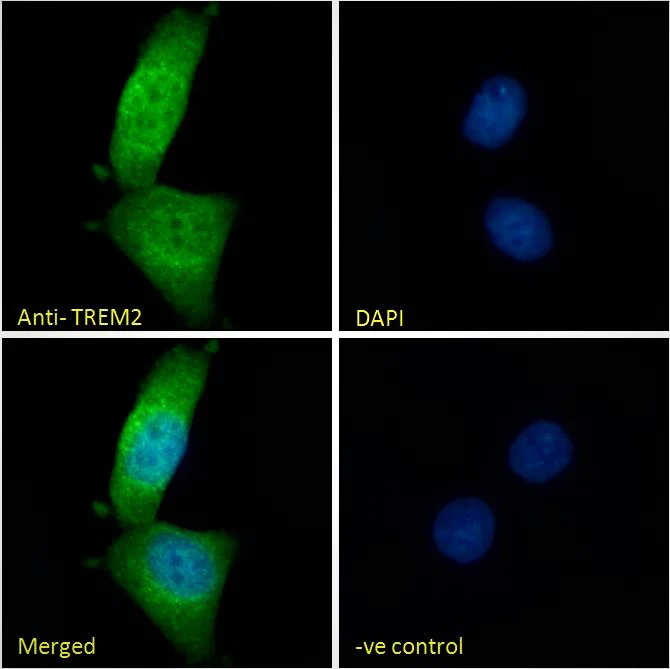 Immunocytochemistry/ Immunofluorescence - Anti-TREM2 antibody - C-terminal (AB223684)