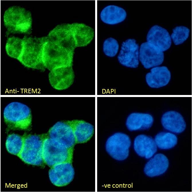Immunocytochemistry/ Immunofluorescence - Anti-TREM2 antibody - C-terminal (AB223684), expandable thumbnail