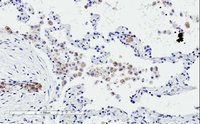 Immunohistochemistry (Formalin/PFA-fixed paraffin-embedded sections) - Anti-TREM2 antibody - C-terminal (AB223684), expandable thumbnail