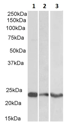 Western blot - Anti-TREM2 antibody - C-terminal (AB223684)