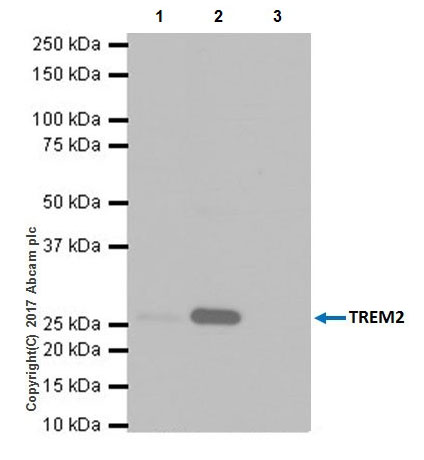 Immunoprecipitation - Anti-TREM2 antibody [EPR20243] (AB209814), expandable thumbnail