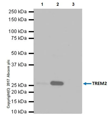 Immunoprecipitation - Anti-TREM2 antibody [EPR20243] (AB209814)