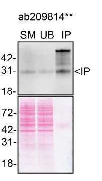 Immunoprecipitation - Anti-TREM2 antibody [EPR20243] (AB209814)
