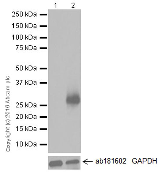 Western blot - Anti-TREM2 antibody [EPR20243] (AB209814), expandable thumbnail