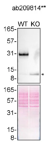 Western blot - Anti-TREM2 antibody [EPR20243] (AB209814)