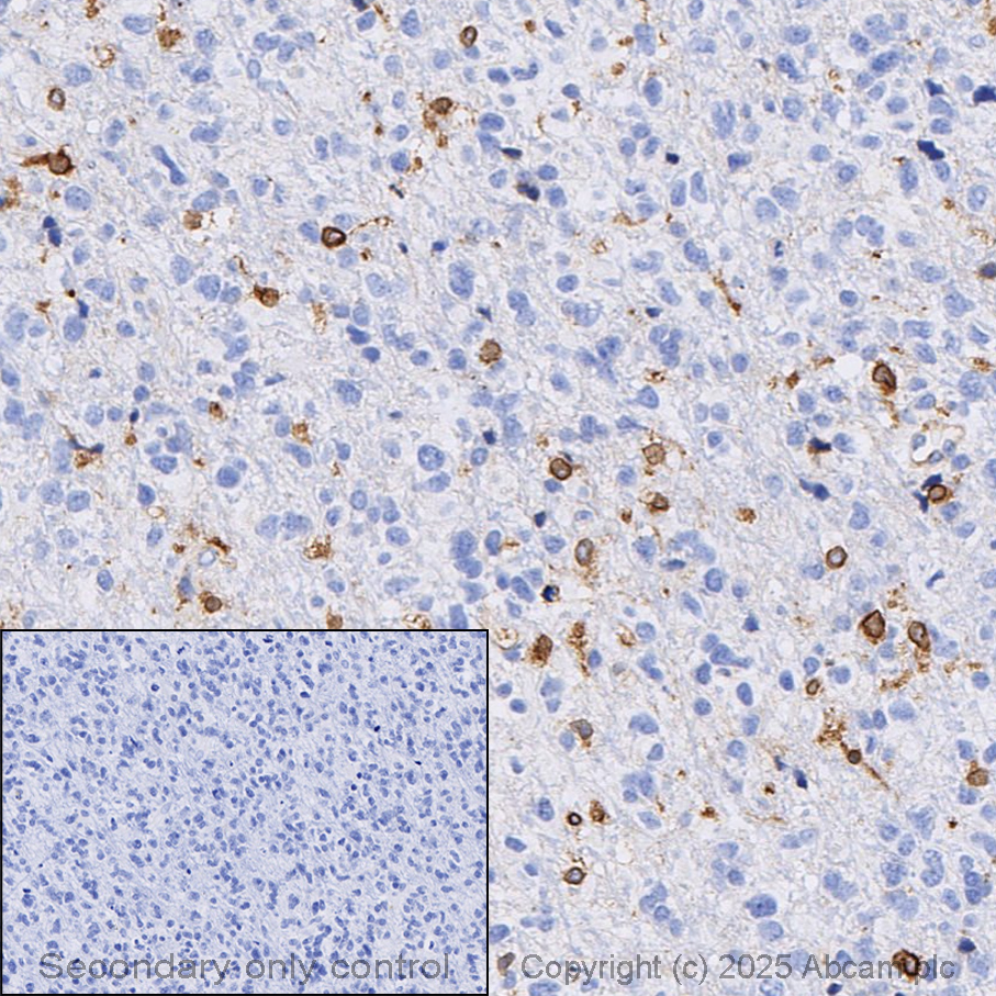 Immunohistochemistry (Formalin/PFA-fixed paraffin-embedded sections) - Anti-TREM2 antibody [EPR26209-22] (AB318262)