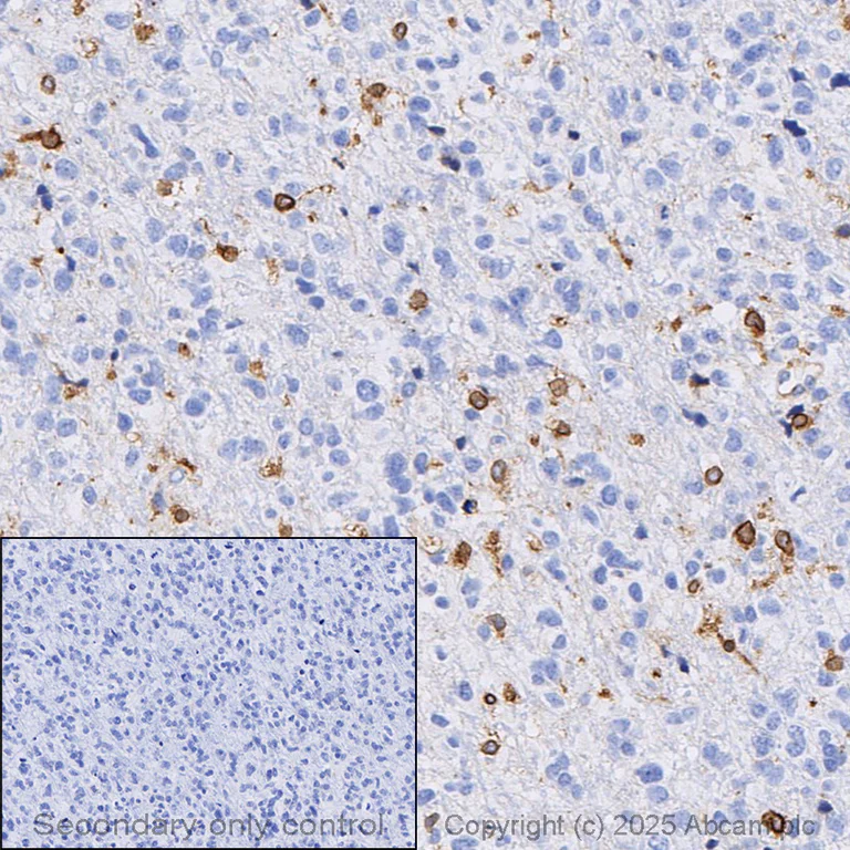 Immunohistochemistry (Formalin/PFA-fixed paraffin-embedded sections) - Anti-TREM2 antibody [EPR26209-22] (AB318262)