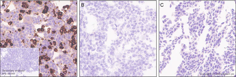 Immunohistochemistry (Formalin/PFA-fixed paraffin-embedded sections) - Anti-TREM2 antibody [EPR26209-22] - BSA and Azide free (AB318263)