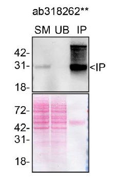 Immunoprecipitation - Anti-TREM2 antibody [EPR26209-22] - BSA and Azide free (AB318263)