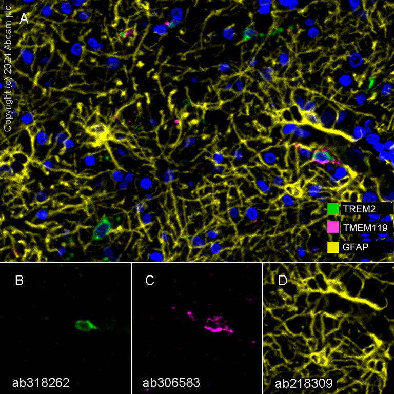 Multiplex immunohistochemistry - Anti-TREM2 antibody [EPR26209-22] - BSA and Azide free (AB318263)